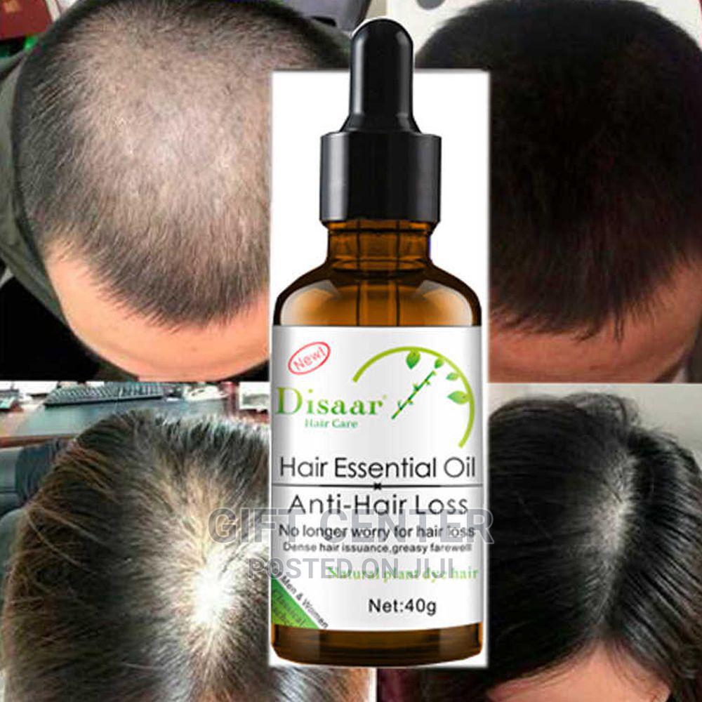 Hair Oil Sri Lanka | Best Hair Growth Oil Price List in Sri Lanka