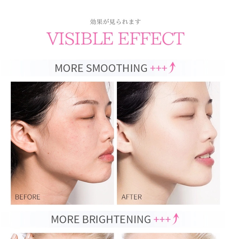 LAIKOU Japan Natural Sakura Serum for Oil Control Brightenin. 
