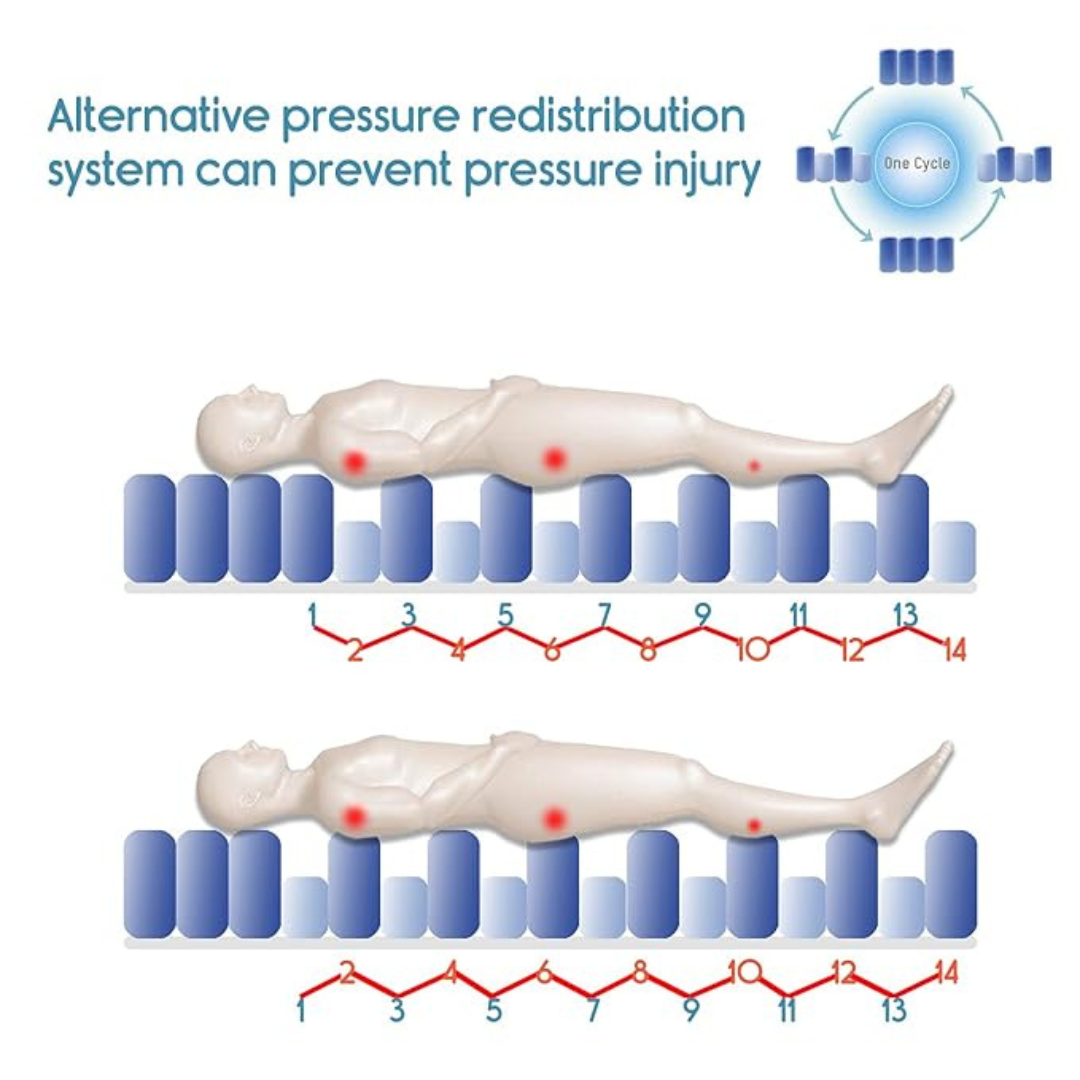 Air Mattress with Pump - Alpha Bed Replacement Alternating Pressure Pad - Inflatable Low Air Loss Mattress Topper For Pressure Ulcer And Sore Relief Treatment - Fits Standard Hospital Bed - For Elderly, Seniors, Bedridden Patients. 