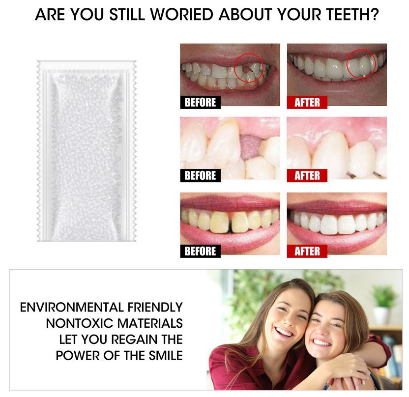10g Teeth And Gap Falseteeth Solid Glue Resin FalseTeeth Solid Glue Temporary Tooth Repair Set Adhesive Teeth. 