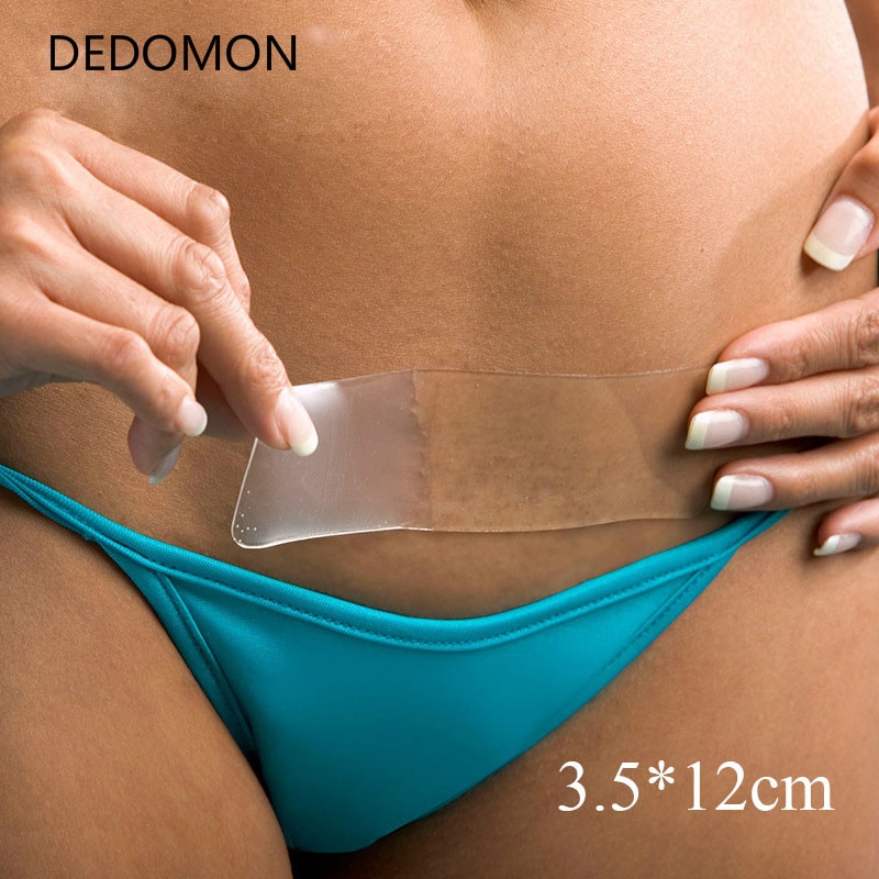 1 【HOT】 Efficient Caesarean Section Surgery Silicone Gel Removal Scar Sheet Therapy Patch For Acne Trauma Burn Scar Skin Repair