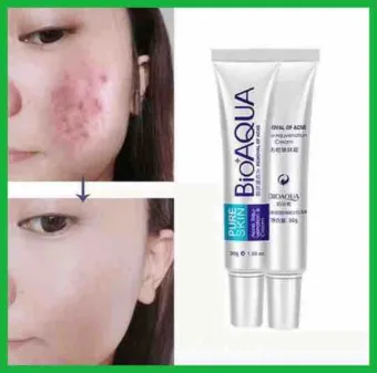 pimples remove face cream