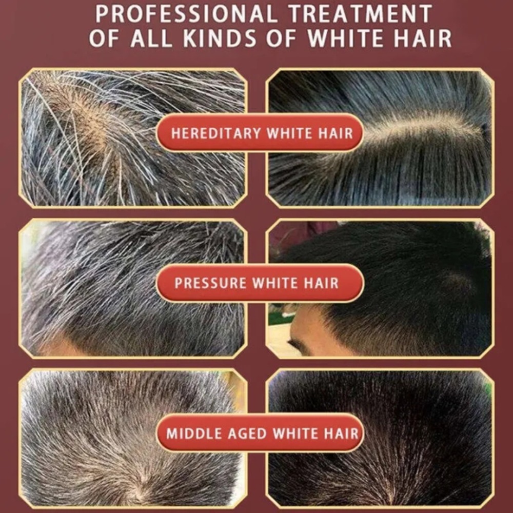 Lasting Anti Gray Hair Treatment Serum, White To Black Hair Growth, Nourish Natural Color Repair, Anti Hair Loss Products, Men And Women. 