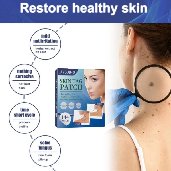 Skin Tags Removal Patches - 144pcs. 