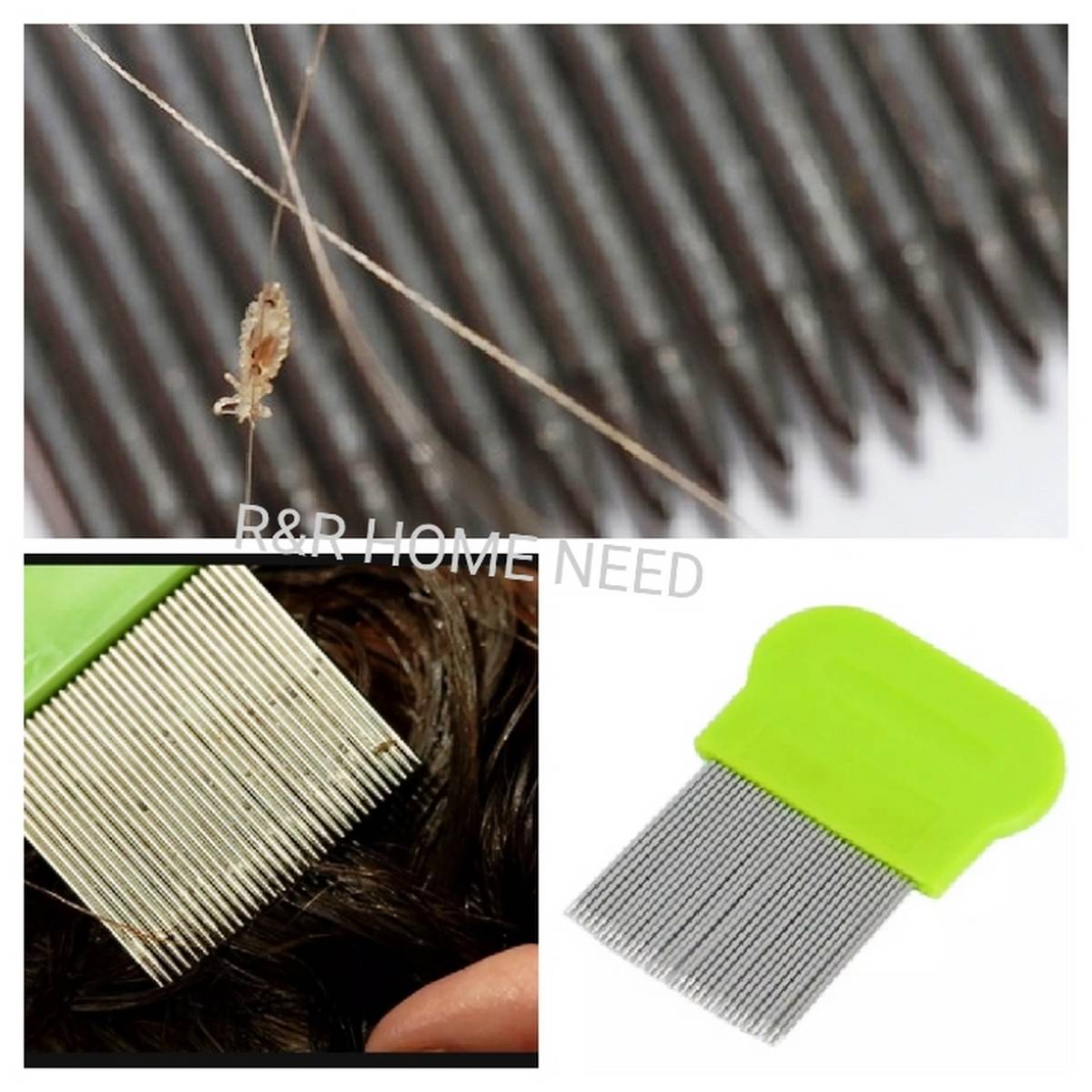Stainless Steel Hair Lice Comb Brush Remove Ticks Slow kids fine tooth chip flee metal nit head lice hair comb Anti-Lice: Buy Online at Best Prices in SriLanka Stainless Steel Hair Lice Comb Brush Remove Ticks Slow kids fine tooth chip flee metal nit head lice hair comb Anti-Lice: Buy Online at Best Prices in SriLanka