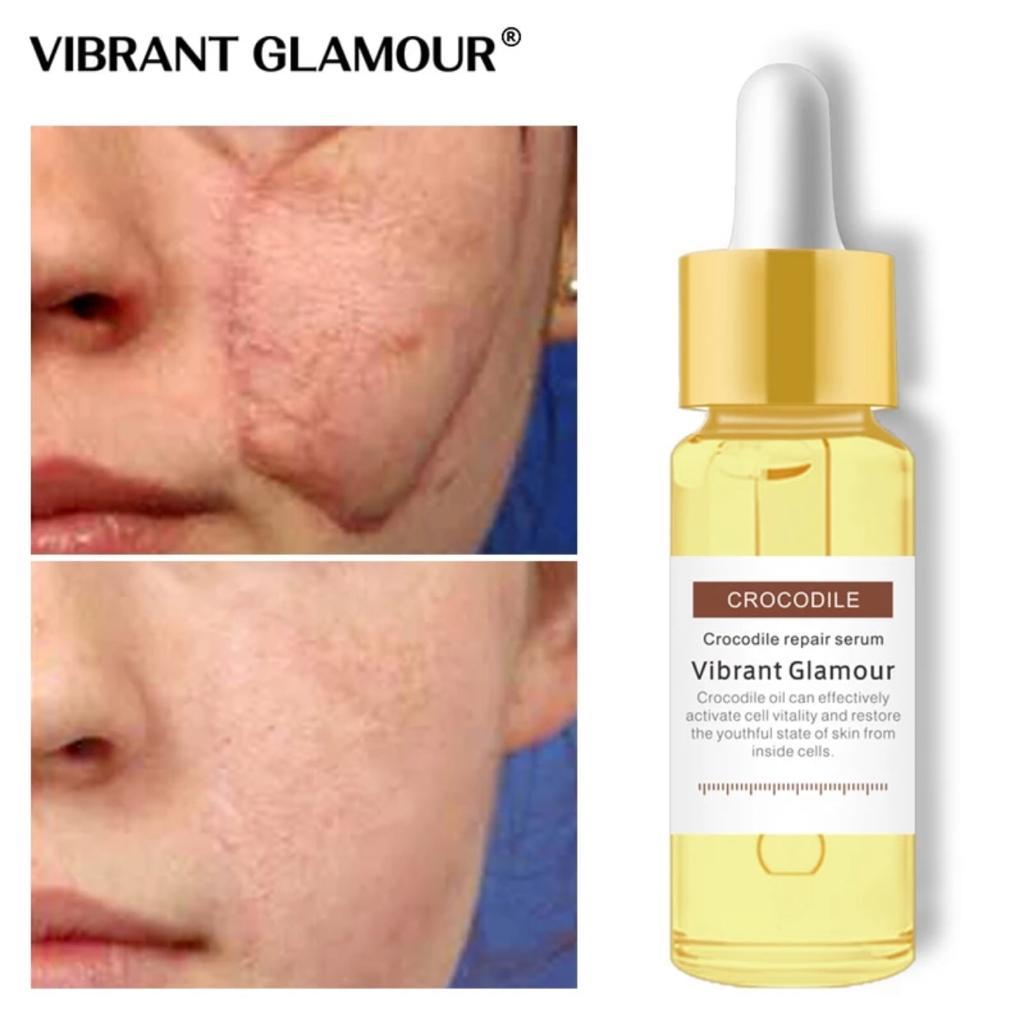 scar serum for face