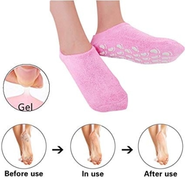Ultra-Soft Moisturizing Spa Gel Heel Sock Exfoliating And Preventing Dryness Foot Skin Rejuvenation Foot Care Elastic Sock Jessica Diabetic Control Socks. 