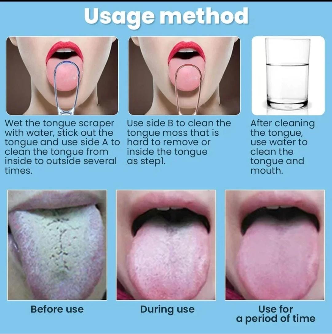 Tongue Cleaner Tongue Cleaning Scraper Reusable Tool Oral Care Hygiene Scraper Cleaning Multicolor Oral Tongue Brush Tongue Cleaners Adult Tongue Coating Cleaning Scraping Off Breath Tongue Cleaning Scraper Food Grade PP Material. 