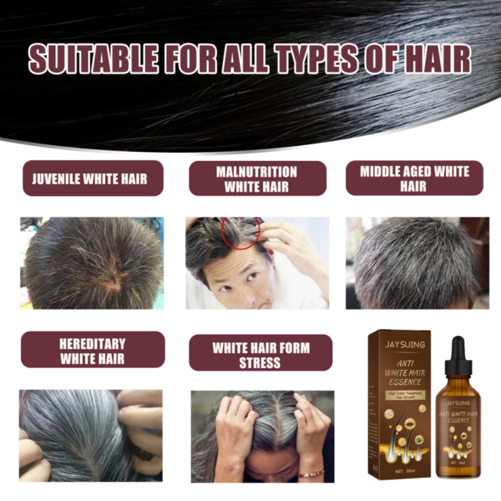 Lasting Anti Gray Hair Treatment Serum, White To Black Hair Growth, Nourish Natural Color Repair, Anti Hair Loss Products, Men And Women. 