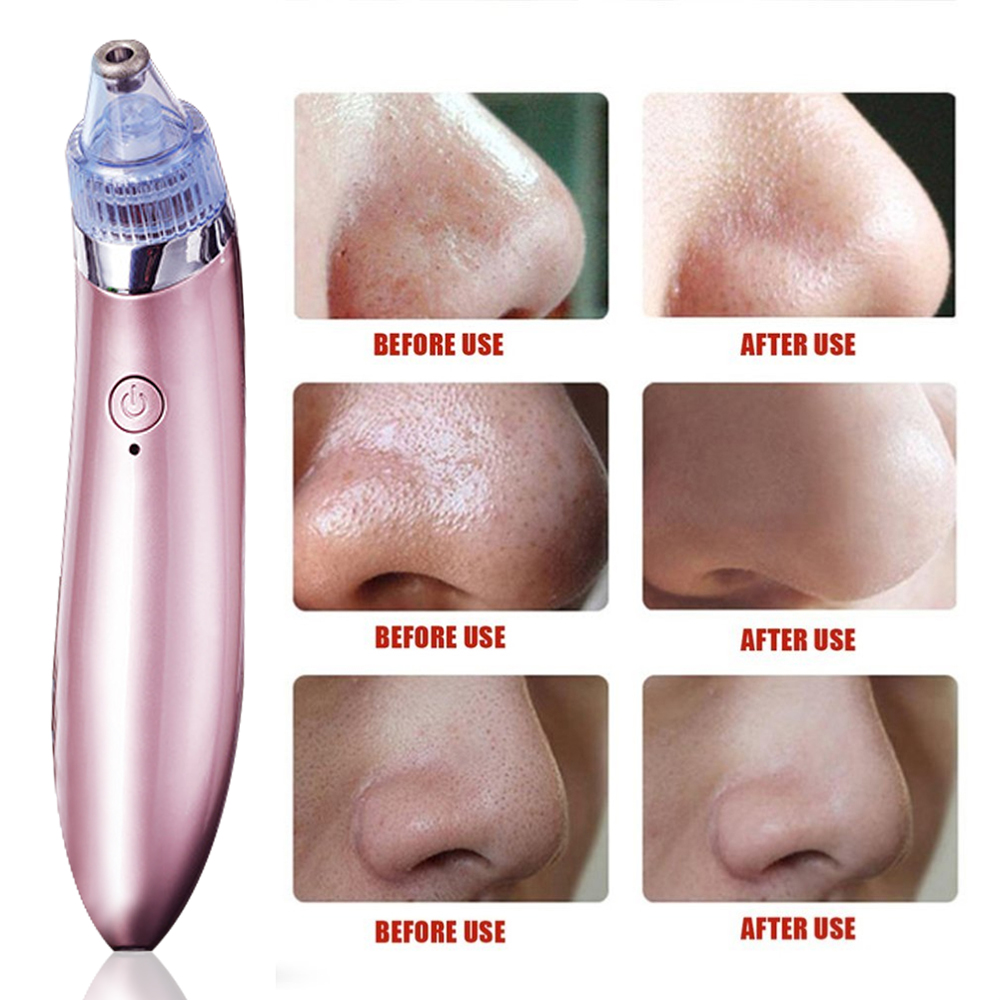 Blackhead Remover Vacuum Acne Cleaner Pore Remover Electric Skin Facial Cleanser Kit. 