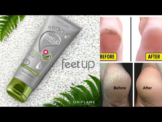 feet up advanced foot cream