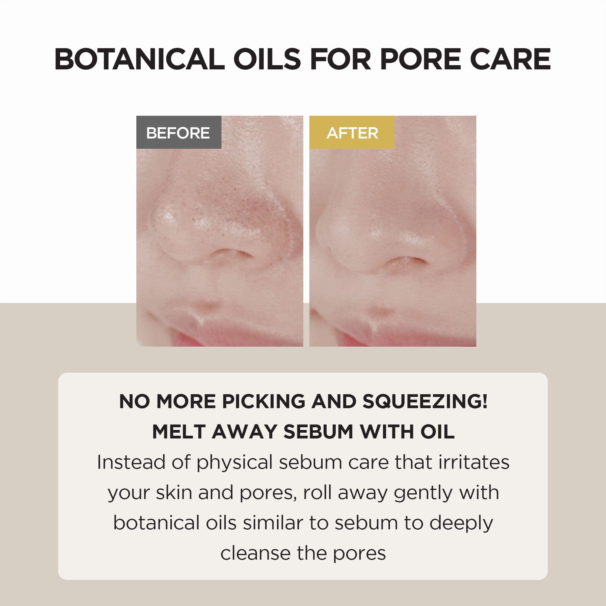 [SKIN1004 OFFICIAL] Madagascar Centella Light Cleansing Oil 30ml | centella asiatica extract | skin irritation | moisturizing skin. 