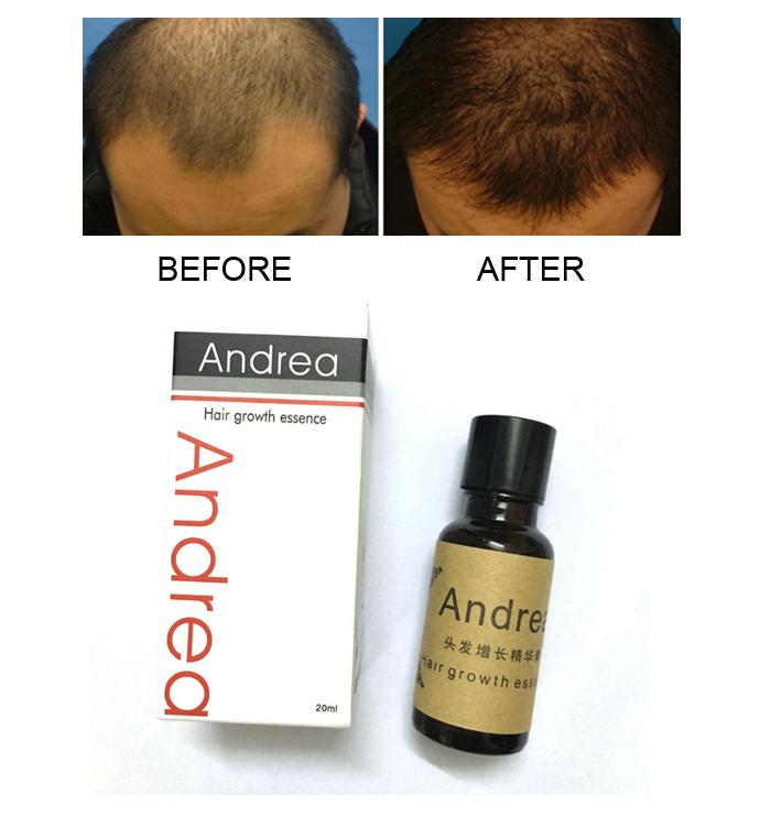 Buy Unlimited Hair Care At Best Prices Online In Sri Lanka Daraz Lk