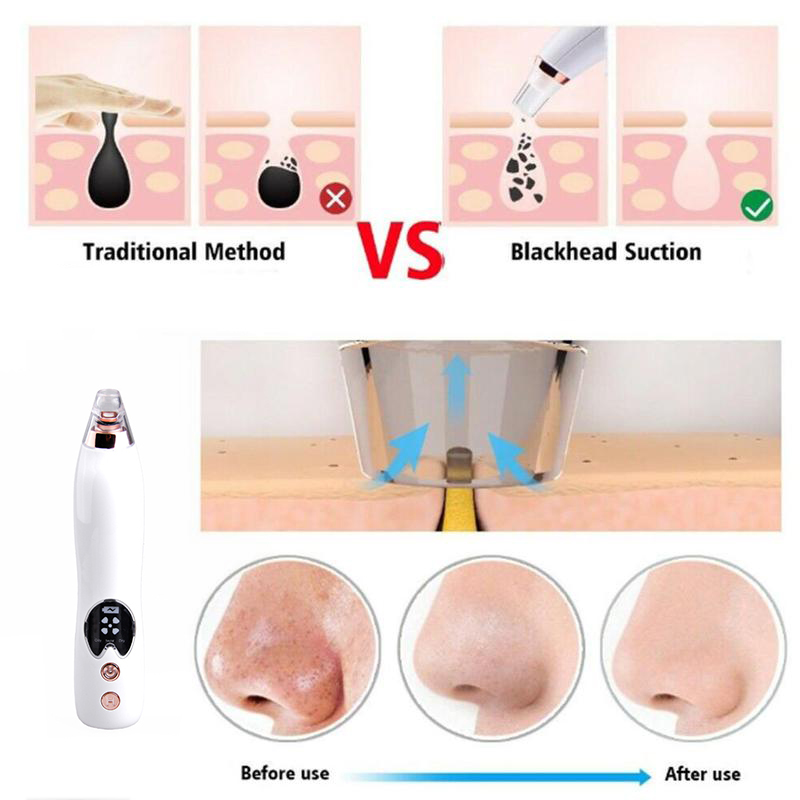 deep pore cleanser vacuum