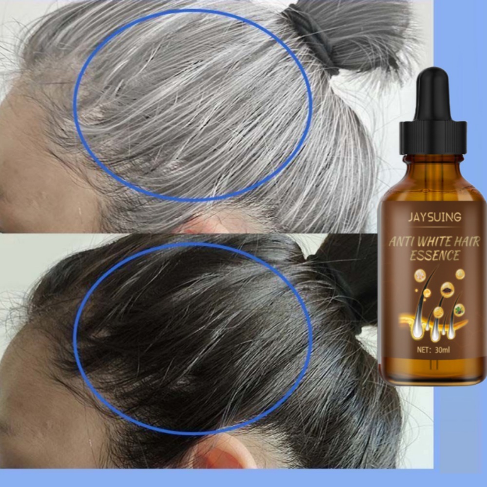 Lasting Anti Gray Hair Treatment Serum, White To Black Hair Growth, Nourish Natural Color Repair, Anti Hair Loss Products, Men And Women