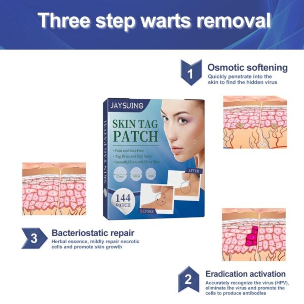 Skin Tags Removal Patches - 144pcs. 