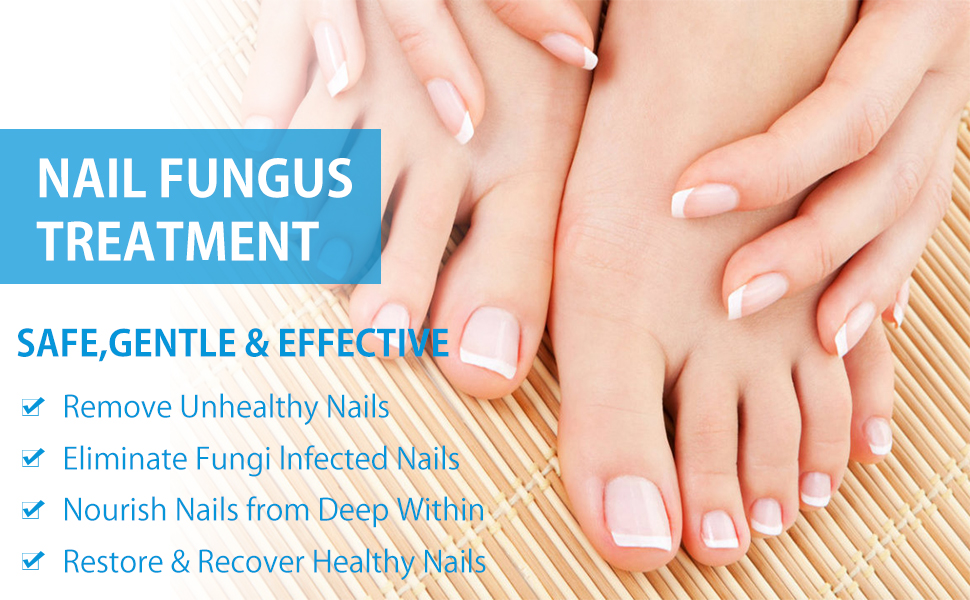 Nail X Cream– 100% Ayurvedic Nail Repair Cream | Powerful Toenail & Fingernail Fungus Treatment- WURDHI Cream -MaxiGrow Herbal Cream Enlargement Cream 100% Ayurvedic. 
