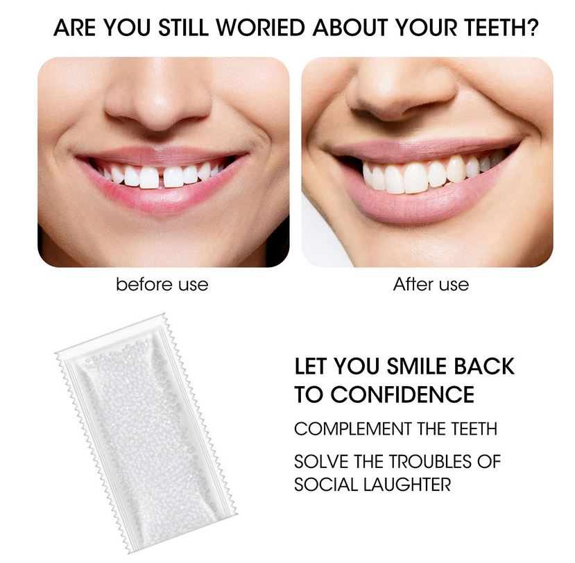 10g Teeth And Gap Falseteeth Solid Glue Resin FalseTeeth Solid Glue Temporary Tooth Repair Set Adhesive Teeth. 